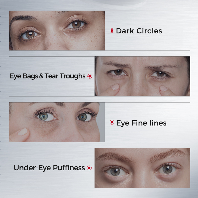 แผ่นปิดตาสำหรับรอยคล้ำใต้ตา –  - Collagen Eye Patch บทวิจารณ์และราคา